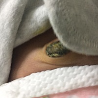 请问我们家宝宝已经45天左右了，肚脐还没掉，是怎么回事，每天也有碘伏消毒，有什么其它办法可以使它快...