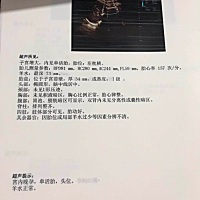 30周去检查胎位不正孩子偏小 医生交代半个月再去B超查胎位和孩子大小，经过半个月走路爬楼梯吃番薯孩子...