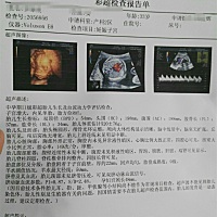 二胎，好想知道是男是女哦😄看得出来吗😊