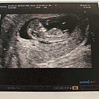 还没来就花了快5千大洋了，也不知道你能不能来到这个世界，你是男孩还是女孩啊……