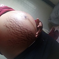 四十周十一，人们常说提前是男孩。推迟。是女孩是这样吗?