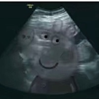 今天NT一次过，超开心的