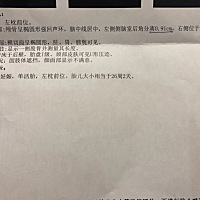 上一周做的B超，宝宝侧脑室后角分离0.91，医生说小于1是正常的，让定期复查，好担心啊，宝宝后期积液吸...