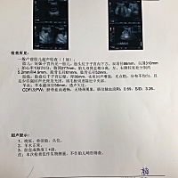 32周了，做了b超，怎么感觉描述的不是很好呢？肾盂分离比上次更大了