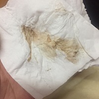 刚才上厕所一擦有黑褐色的分泌物，什么原因求解、这么晚现在去不了医院了