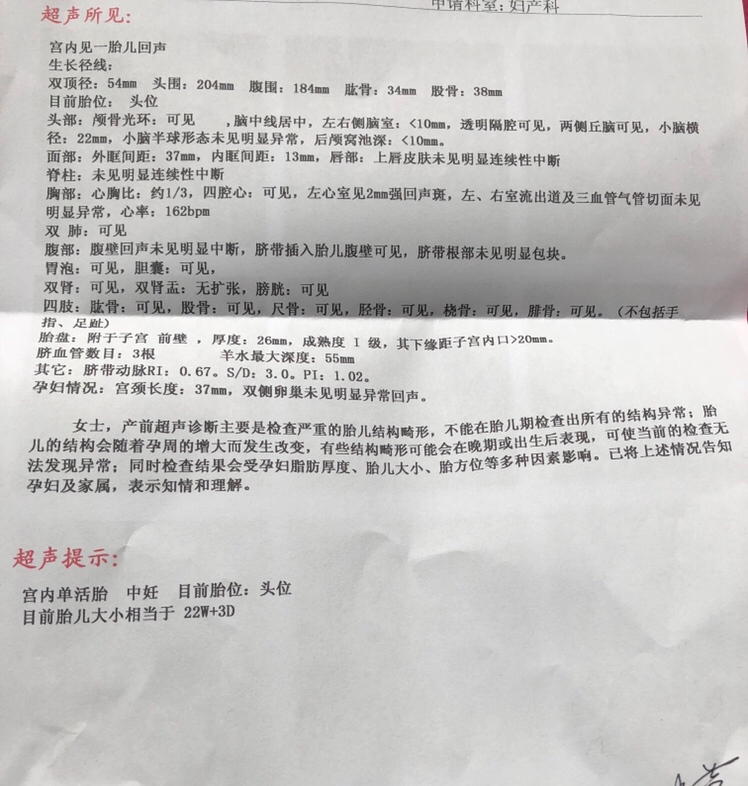 有人会看这个单子吗？