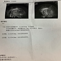 12月9日末次月经，今天检查B超孕囊旁有积血，不知道小朋友健不健康。