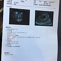 今天第一次去做b超，结果不错。但是孕酮从18降到12了，希望后期回升。🐷