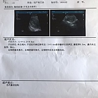 老婆确定怀孕了，现在5周零4天，连续三四天有褐色分泌物，不是很多，今天下午发现有点血，不多，想问问...