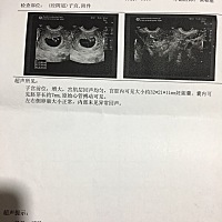 52天时候做的b超，各位宝妈帮我看看孕囊数据，是男孩还是女孩
