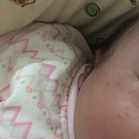 宝宝脸上这些东西有哪位宝妈知道是什么东西？有什么办法可以消退吗？