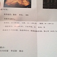 大家能帮我看看吗？