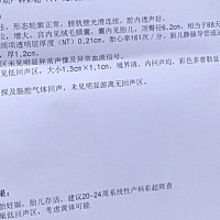 这个NT结果是好的么