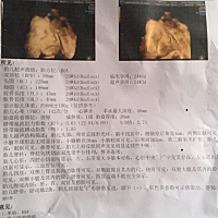 四维检查，想知道男孩女孩，我家老大是个女儿