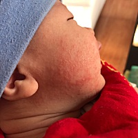 宝宝这样好几天了，有没有懂的，帮忙看看是什么，谢谢了