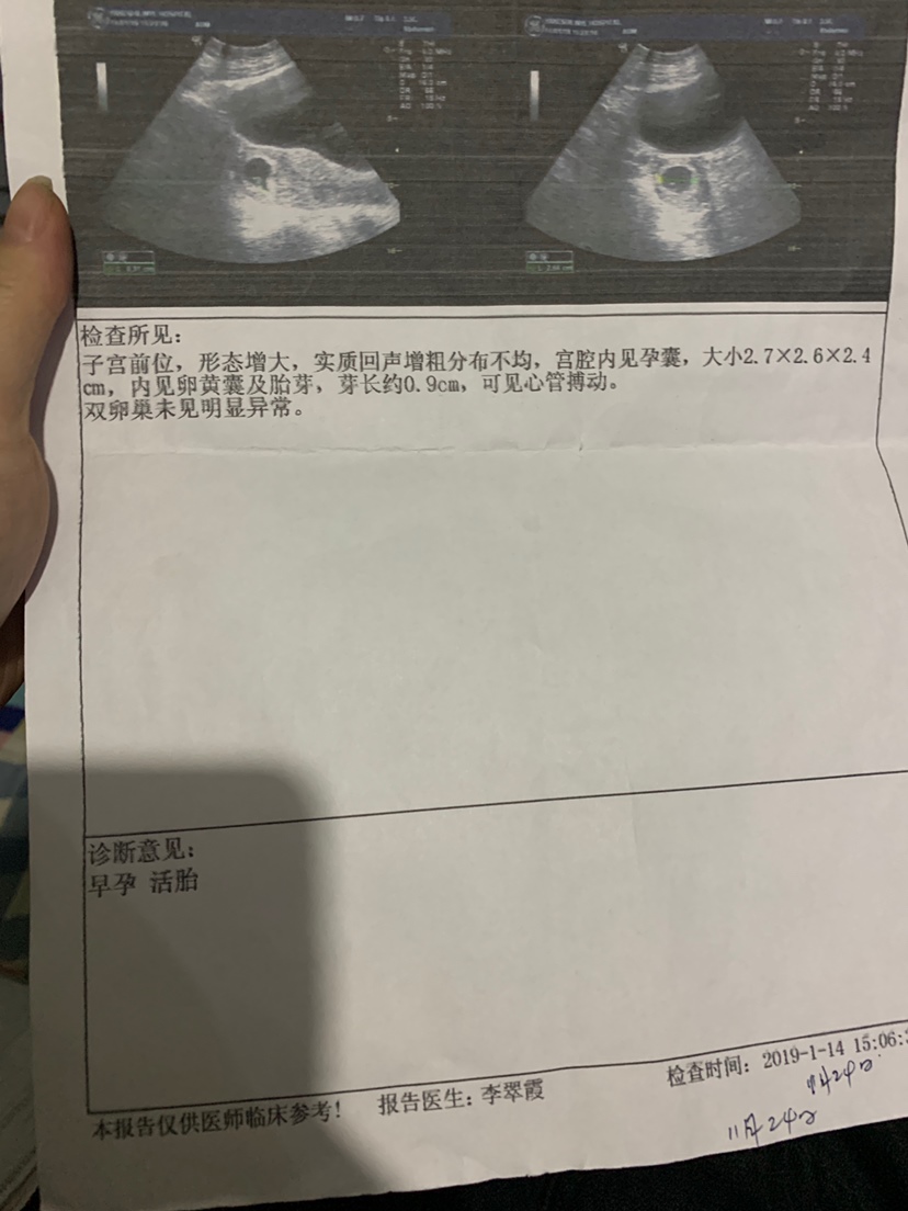 有没有宝妈知道我这是怀孕多久了吗？？我不来月经因为7月份做过巧囊手术，术后打了防止复发的针，这个针打了不来月经，最后一针打了有4个月一直没来过月经，然后发现怀孕，无任何反应征兆，都不知孩子多大了