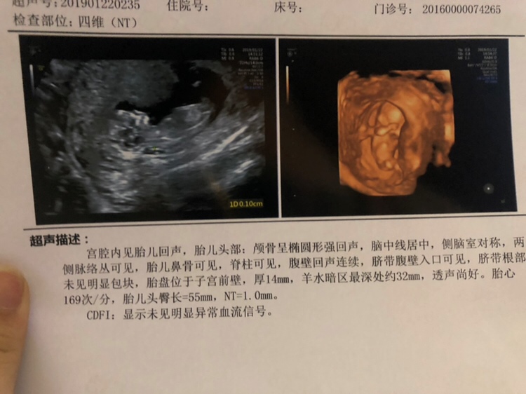 nt比想象中简单太多 医生全程无交流 
照出来清晰度超级满意哒 头 肚子 脚都比较清楚 💰300