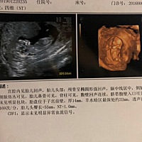 nt比想象中简单太多 医生全程无交流  照出来清晰度超级满意哒 头 肚子 脚都比较清楚 💰300