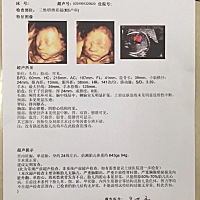 第一次看到宝宝的脸😊 一次过😊