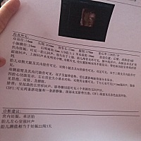 有没有懂的 这单子有问题吗 去检查四维 结果单子显示是做的三维 纳闷 难道是医院没有四维 有必要再去做...