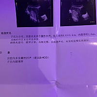 怀孕了差不多30天左右，今天去了医院查了一下b超，先进去的b超三室，结果查完医生又带我去了b超一室，又...
