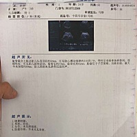 猜猜看是男孩女孩，快卸货了，大家来见证一下，到底准不准？