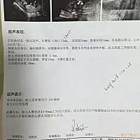 就像买彩票似的，总想开奖，迫不及待的那种，虽说男孩女孩健康就好，可还是忍不住的去猜想，哪位亲给看...