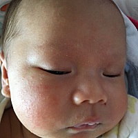 这是什么情况呀脸上，差不多40天的宝宝