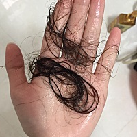 不是一条两条掉是一把一把掉。怎么办呀？头发本身不少这样掉法很快会掉没有了，我不想成秃子，好难看的...