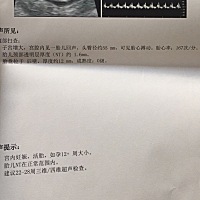 刚做完NT 周五拿抽血报告在一起给医生看
