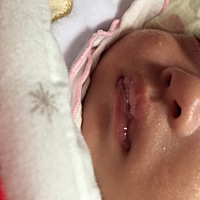 我家宝宝经常吐泡沫，这是怎么回事？