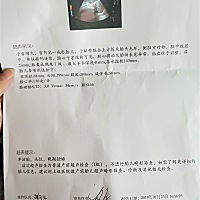 哪位宝妈会算体重  帮我看看