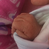 宝宝七天了，前两天开始全身脱皮，正常吗啊？想问你们宝宝也会脱皮吗？需不需要擦点什么啊