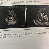 12+4周血常规彩超检查，都挺顺利，有没有经验足的给帮忙看看是男孩还是女孩，我自始至终都觉得男女都一...
