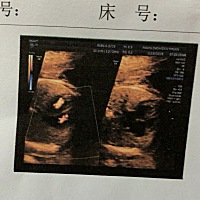 请问这是双胞胎吗，不懂看