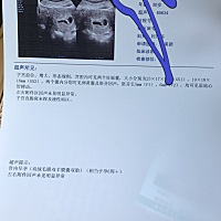 喜接双胎，人生第一大惊喜，不知是男是女？大家猜一猜
