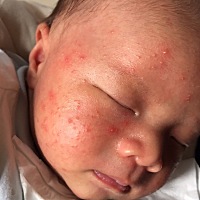 涂了两天就好了，这是这么久以来最感激婆婆的一件事了