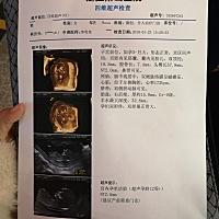 小佩琪☀️第一次见面，妈妈好激动。余生你是妈妈的软肋也是妈妈的盔甲！