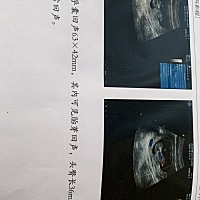 B超今天查的比孕周小一周，这正常吗？