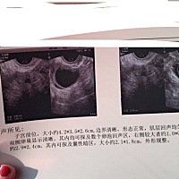 吃着促排的药，但是一直不排，会不会最后形成囊肿？