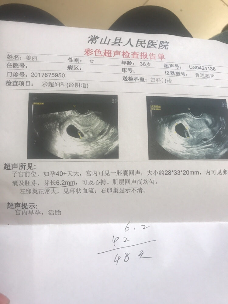 B超回来了.