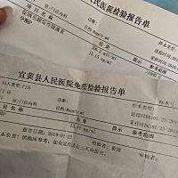 上个月22号来的月经到今天32天 孕酮和hcg这么低正常吗