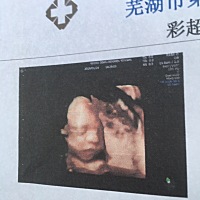 做三维的时候医生说小孩胳膊长腿长以后打篮球 医生在暗示我什么吗 凉凉