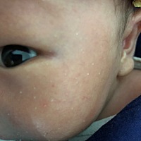 谁知道刚出生的婴儿脸上出的这白点点是什么东西吗？？