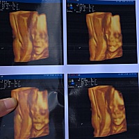 历经千辛万苦……愿宝宝健康快乐的成长！