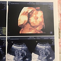 姐妹们、你们的四维照都是这样么😓我咋看不出像谁🤣🤣🤣