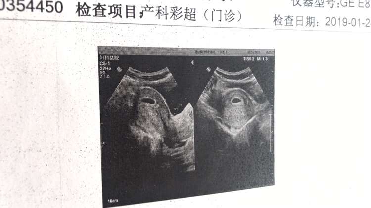 六周 ，恶心头晕无力所有的不适都找到了我，昨天打了维生素b6，vc等，症状好像有点减轻，希望各位不舒服的宝妈也坚强些！