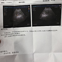怀孕两个多月不孕吐不挑饭，大概就是自己太强大所以无人问津，老公和婆婆的态度真是让人心寒，谁都靠不...