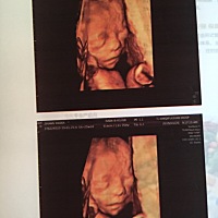 四维彩超出来了，哪位大师帮忙看看男女