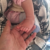 宝宝脚踝处这样正常吗